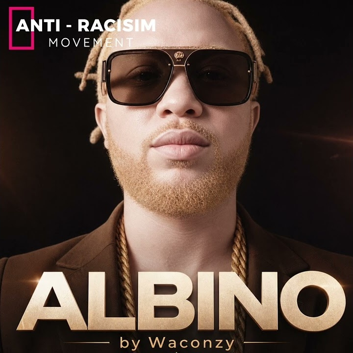 ALBINO by WACONZY